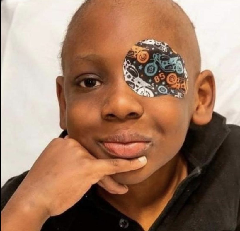 Nathaniel with his patterned eye patch